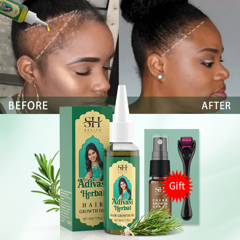 Ayurvedic Hair Growth Oil Indi - đánh giá và giá Ingrown Hair Serum
