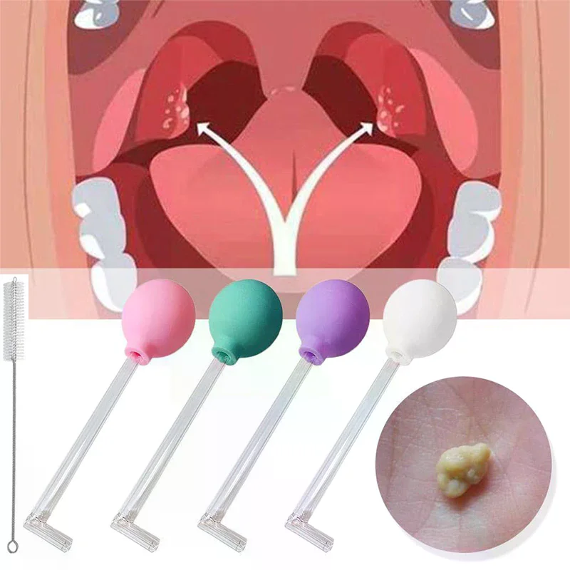 Stone Remover Tool Manual Styl - đánh giá và giá Ear Wax Remover