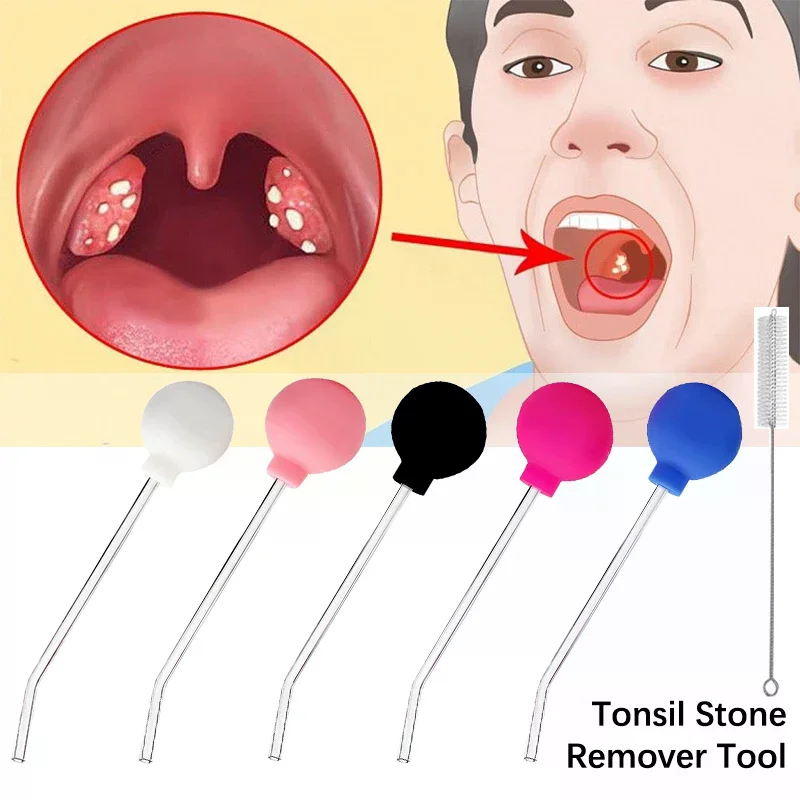 Stone Remover Tool Manual Styl - đánh giá và giá Ear Wax Remover
