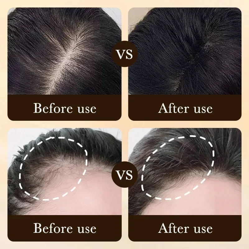 Biotin Fast Hair Growth Oil Pr - đánh giá và giá Ingrown Hair Serum