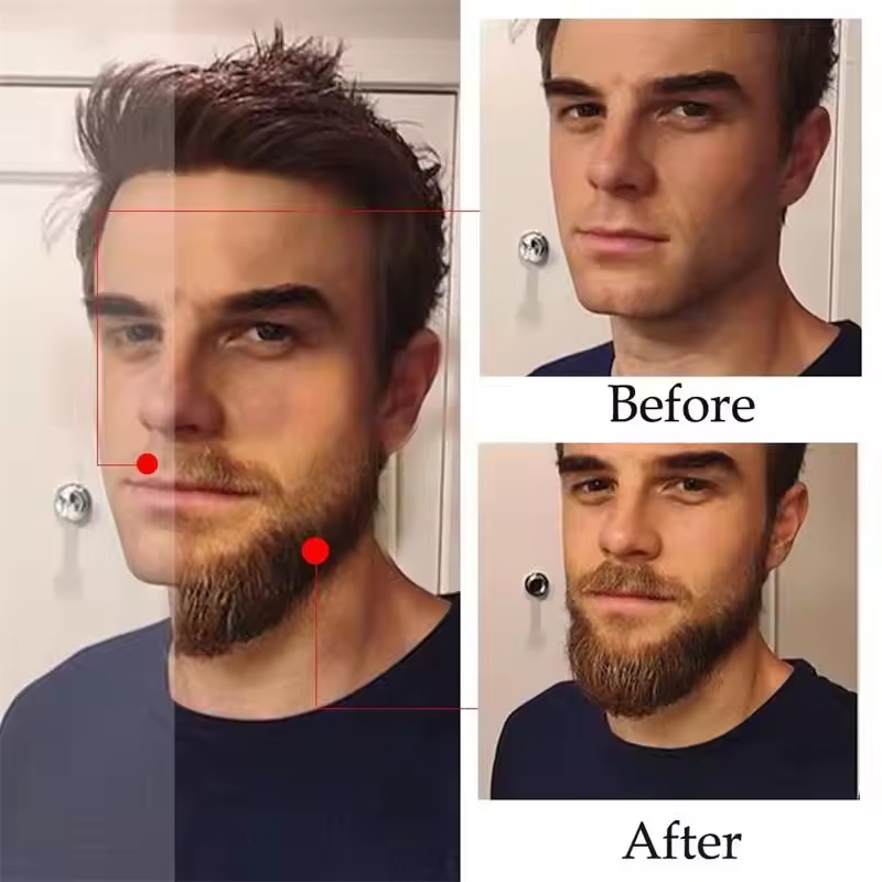 Fast Natural Mature Men Beard  - đánh giá và giá Ingrown Hair Serum