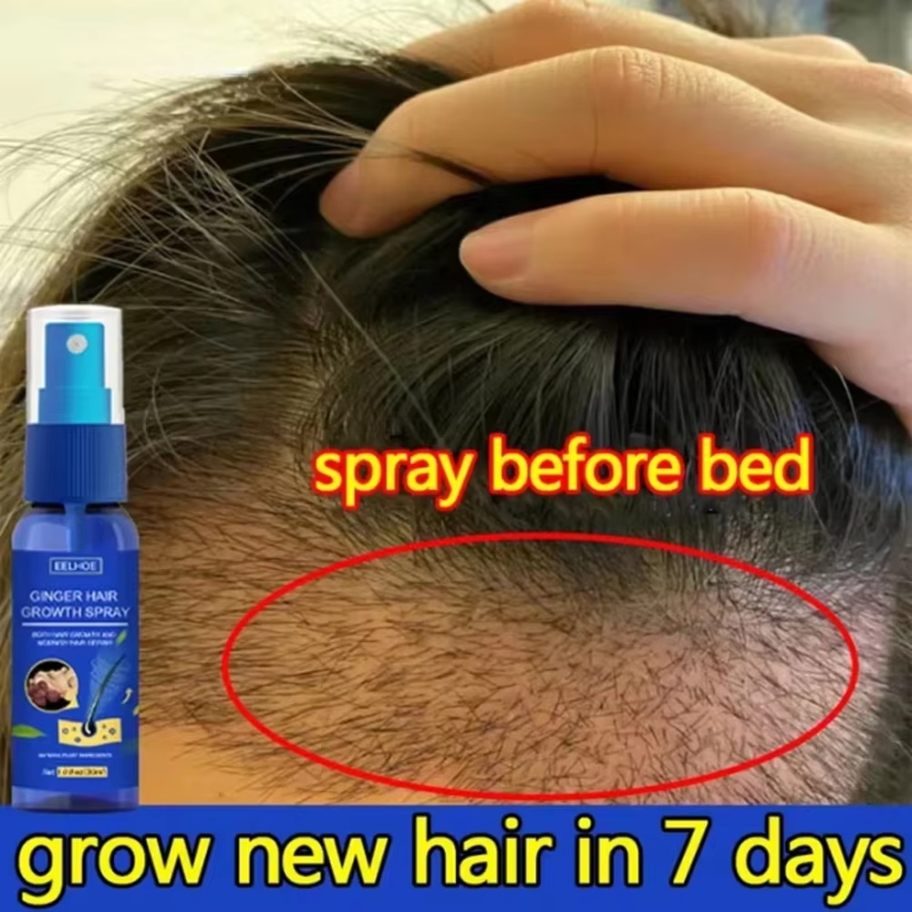 Fast Ginger Hair Growth Spray  - đánh giá và giá Ingrown Hair Serum